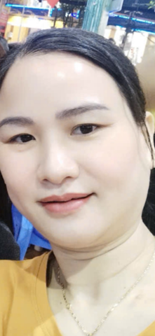 Mi Nguyễn