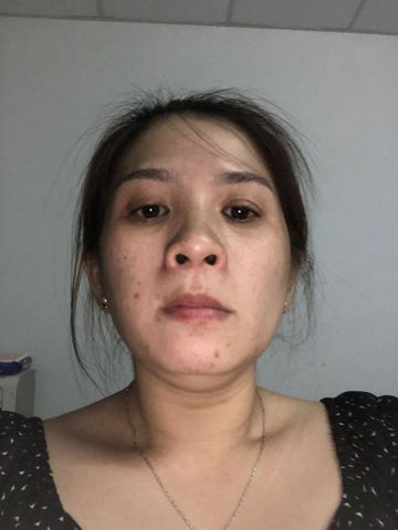 Trang