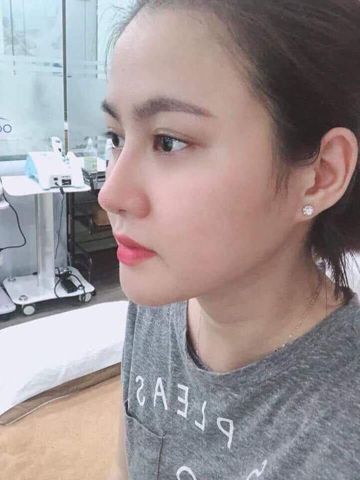 huyền