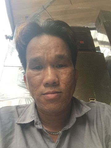 Nguyenminhchau